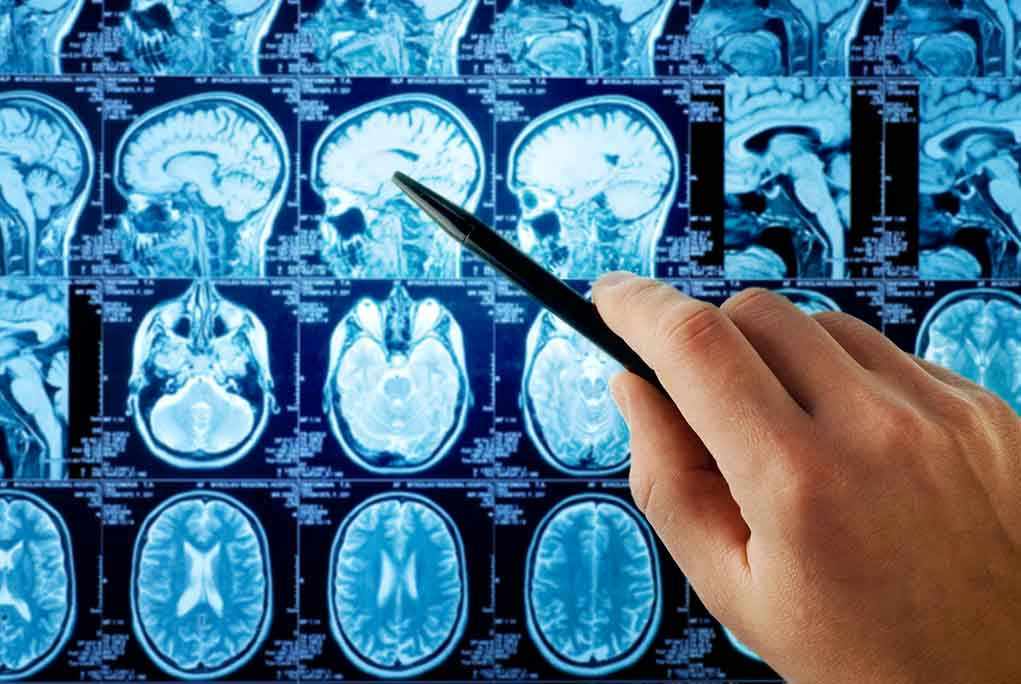 Hand pointing at brain scan images on screen