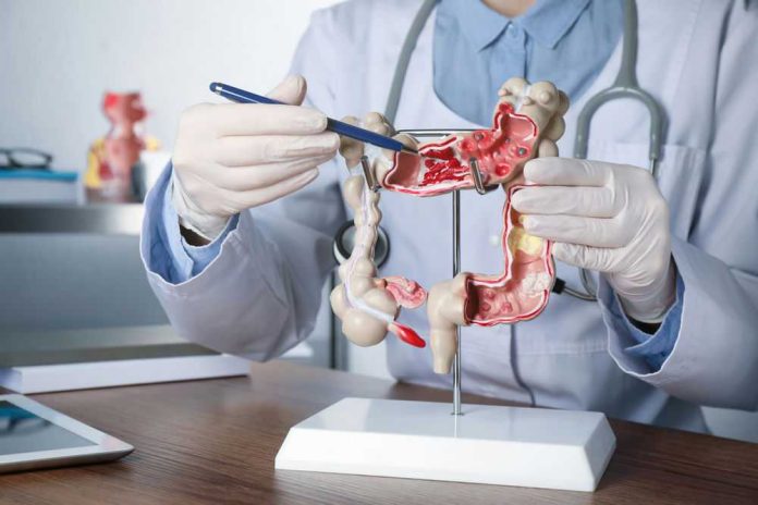 1999071686 Doctor pointing at anatomical model of the colon.
