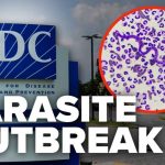 Parasite Bomb Hits 45 States CDC warns of cyclosporiasis parasite outbreak spreading across US